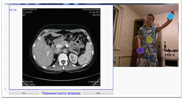 dicom_demo_pic