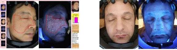 Magic Skin Analyzer