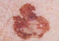 http://mosderm.ru/uploads/Statiy/.jpg