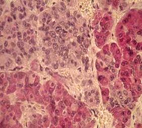 http://www.histol.chuvashia.com/images/endocrine/pituitary-03.jpg