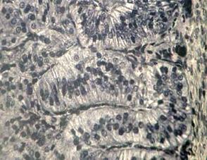 http://www.histol.chuvashia.com/images/endocrine/adrenal-02.jpg