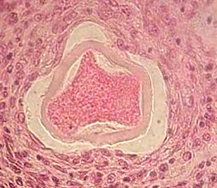 http://www.histol.chuvashia.com/images/female/ovary-07.jpg