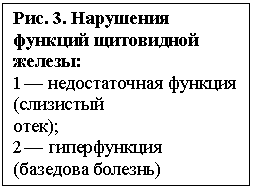 �������: