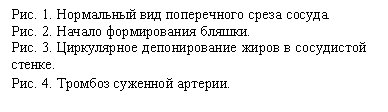�������: