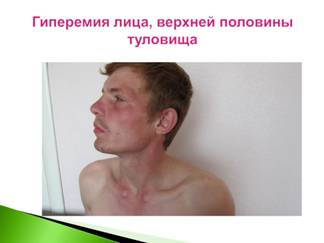 http://img.slidespace.ru/2013/07/01/1830/15.jpg