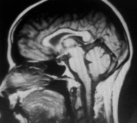 H:\DCIM\100SSCAM\SDC10003.JPG