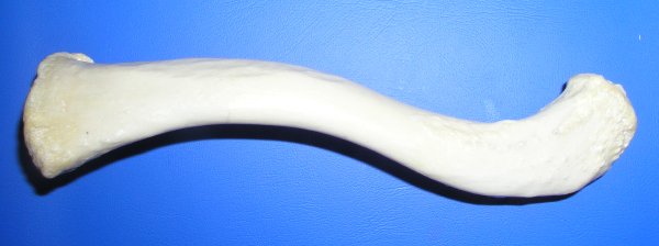 Файл:Clavicula sup.jpg