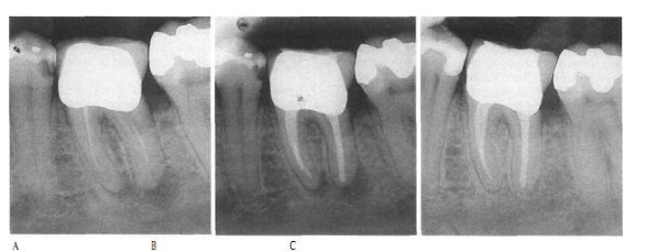 endodontia6.jpg