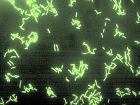 Legionella