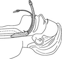 http://vmede.org/sait/content/Anatomija_topograficheskaja_sukov_xir_bol_2008/21_files/mb4_017.jpeg