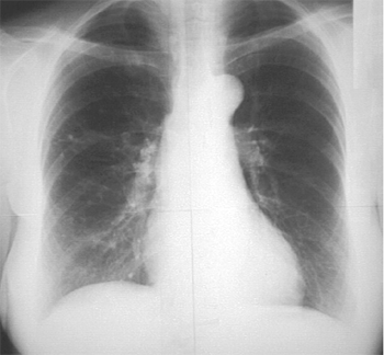 http://medbook.medicina.ru/images/430/132787/r2_81.gif