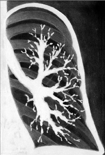 http://medbook.medicina.ru/images/432/134925/r2_90.gif