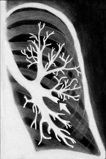 http://medbook.medicina.ru/images/432/134926/r2_89.gif