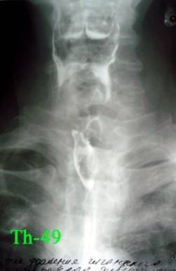 th-49