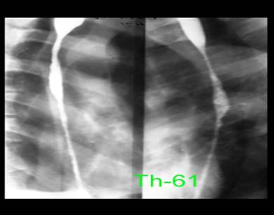 th-61