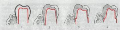 https://proxy.imgsmail.ru/?h=EOdXgK3X6TB_AZMKPmM3Lw&e=1353332314&url717=www.dentaltechnic.info/Ortopedicheskaja_stomatologija_Kopejkina_files/Ortopedicheskaja_stomatologija_Kopejkina-84.jpg