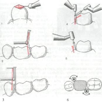 https://proxy.imgsmail.ru/?h=wdDRZ_bRVQHQUEH5T0LSBA&e=1353332314&url717=www.dentaltechnic.info/Ortopedicheskaja_stomatologija_Kopejkina_files/Ortopedicheskaja_stomatologija_Kopejkina-79.jpg