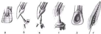 http://clubdent.narod.ru/profess/knigohr/clinendo/images/image022.jpg