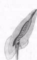 http://clubdent.narod.ru/profess/knigohr/clinendo/images/image028.jpg