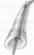 http://clubdent.narod.ru/profess/knigohr/clinendo/images/image032.jpg