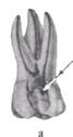 http://clubdent.narod.ru/profess/knigohr/clinendo/images/image064.jpg