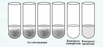http://nsau.edu.ru/images/vetfac/images/ebooks/microbiology/stu/immun/pict/ra3.gif