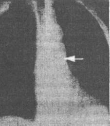 ��������: http://www.dentaltechnic.info/Klinicheskaja_ortopedicheskaja_stomatologija_Iordanishvili_files/Klinicheskaja_ortopedicheskaja_stomatologija_Iordanishvili-50.jpg