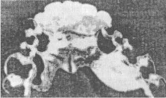 ��������: http://www.dentaltechnic.info/Klinicheskaja_ortopedicheskaja_stomatologija_Iordanishvili_files/Klinicheskaja_ortopedicheskaja_stomatologija_Iordanishvili-52.jpg