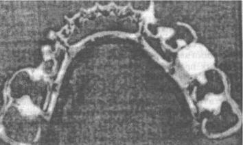 ��������: http://www.dentaltechnic.info/Klinicheskaja_ortopedicheskaja_stomatologija_Iordanishvili_files/Klinicheskaja_ortopedicheskaja_stomatologija_Iordanishvili-53.jpg
