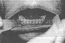 ��������: http://www.dentaltechnic.info/Klinicheskaja_ortopedicheskaja_stomatologija_Iordanishvili_files/Klinicheskaja_ortopedicheskaja_stomatologija_Iordanishvili-54.jpg