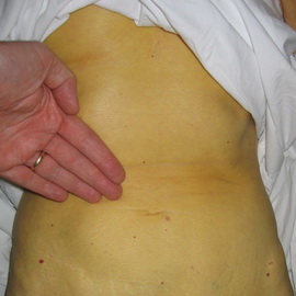 http://med-pomosh.com/wp-content/uploads/2014/05/2107a-262.jpg