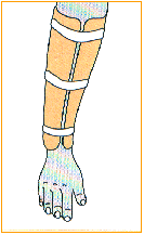 C:\webserver\ortho-titan.com\www\catalog\turbo\Images\index-27.gif