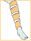 C:\webserver\ortho-titan.com\www\catalog\turbo\Images\index-40.gif
