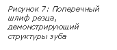 �������: