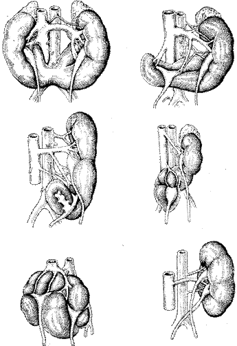 http://uroweb.ru/catalog/med_lib/uro_gin_kan/img/029.gif