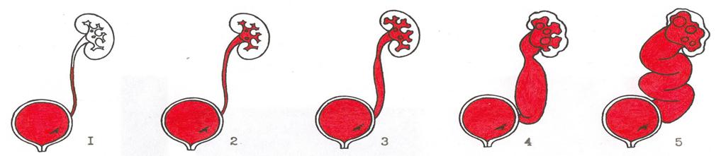 http://www.urologiyardkb.ru/media/pic/lbox/5/klassifikatsiya_pmr.jpg