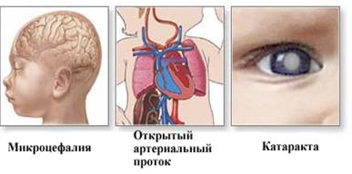 http://okeydoc.ru/wp-content/uploads/2015/09/1429537106_2.jpg