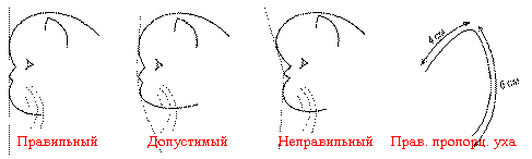 Экстремалы - правильный, допустимый, неправильный профили. Правильные пропорции уха