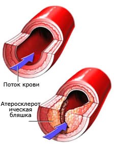 ������ 4