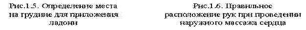 wpeA.jpg (9531 bytes)