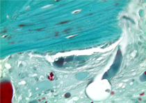 \\HISTOLAB\homes\Smbatyan Bagrat\BagratSerg\Kim Doyana\KimDoyana �46\�������� �46_5_3_�40_1 �������.tif