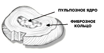 Описание: http://www.orthospine.ru/library/patient/img/borchenko_02.jpg
