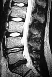 ��������: http://www.orthospine.ru/library/patient/img/borchenko_05.jpg