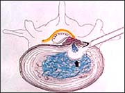 Описание: http://www.orthospine.ru/library/patient/img/18697.jpg