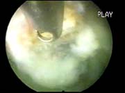 Описание: http://www.orthospine.ru/library/patient/img/18698.jpg