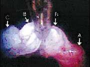 Описание: http://www.orthospine.ru/library/patient/img/18699.jpg