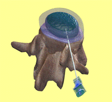 ��������: http://www.orthospine.ru/library/patient/img/borchenko_06.png