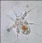 C:\Users\1\Desktop\Nauplius_larva_of_a_cyclops_copepod.jpg
