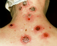 http://www.krasotaimedicina.ru/upload/iblock/1ca/1ca97574b94471e3f290f4ddcc2497a3.jpg