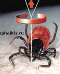 Извлечение Клеща